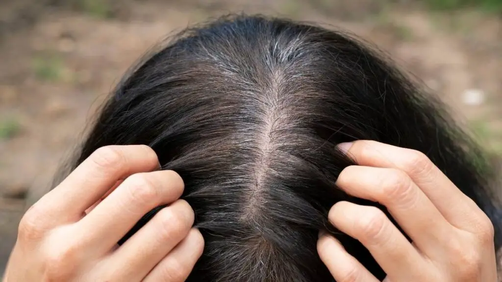What foods are effective in preventing white hair?