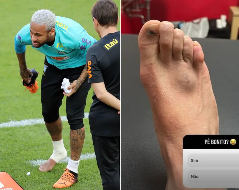 Neymar is out of the game with a foot injury